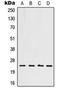 Homeobox protein Hox-B7 antibody, orb214051, Biorbyt, Western Blot image 