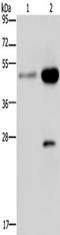 CD160 antigen antibody, TA349762, Origene, Western Blot image 