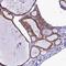 Ring Finger Protein 126 antibody, HPA043050, Atlas Antibodies, Immunohistochemistry paraffin image 