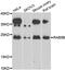 Ras-related protein Rab-5B antibody, abx006959, Abbexa, Western Blot image 
