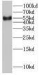Nucleoporin 54 antibody, FNab05926, FineTest, Western Blot image 