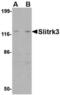 SLIT And NTRK Like Family Member 3 antibody, TA306525, Origene, Western Blot image 