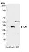 Linker For Activation Of T Cells antibody, A305-893A-M, Bethyl Labs, Western Blot image 