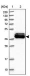 Mitochondrial Ribosomal Protein S31 antibody, PA5-58651, Invitrogen Antibodies, Western Blot image 