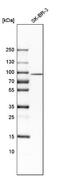 Adseverin antibody, NBP1-89230, Novus Biologicals, Western Blot image 
