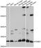 Proteasome Subunit Beta 7 antibody, A08095, Boster Biological Technology, Western Blot image 