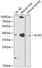 Aminolevulinate Dehydratase antibody, 14-396, ProSci, Western Blot image 