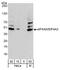 Eukaryotic initiation factor 4A-III antibody, A302-981A, Bethyl Labs, Western Blot image 