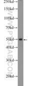 Sterile Alpha Motif Domain Containing 14 antibody, 22009-1-AP, Proteintech Group, Western Blot image 
