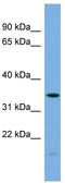 Phospholipid Scramblase 1 antibody, TA344739, Origene, Western Blot image 