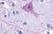 NK3R antibody, GTX70851, GeneTex, Immunohistochemistry paraffin image 