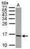 NADH dehydrogenase [ubiquinone] iron-sulfur protein 5 antibody, NBP2-19506, Novus Biologicals, Western Blot image 