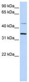 Ceroid-lipofuscinosis neuronal protein 6 antibody, TA342045, Origene, Western Blot image 