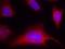 Protein Kinase D1 antibody, GTX50160, GeneTex, Immunocytochemistry image 