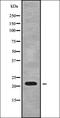 Ribosomal Protein L18a antibody, orb337923, Biorbyt, Western Blot image 
