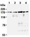 DNA topoisomerase 2-alpha antibody, ADI-KAM-CC215-E, Enzo Life Sciences, Western Blot image 