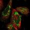 Translocase Of Inner Mitochondrial Membrane 29 antibody, NBP1-94151, Novus Biologicals, Immunofluorescence image 
