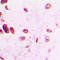 Transcription Factor AP-2 Alpha antibody, LS-C352913, Lifespan Biosciences, Immunohistochemistry frozen image 