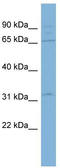ADAM Metallopeptidase Domain 30 antibody, TA338475, Origene, Western Blot image 