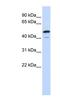 Spermatogenesis Associated 2 Like antibody, NBP1-56681, Novus Biologicals, Western Blot image 