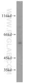 HCK Proto-Oncogene, Src Family Tyrosine Kinase antibody, 11600-1-AP, Proteintech Group, Western Blot image 