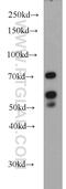 LYN Proto-Oncogene, Src Family Tyrosine Kinase antibody, 18135-1-AP, Proteintech Group, Western Blot image 