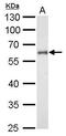 Cytochrome P450 Family 1 Subfamily B Member 1 antibody, PA5-28040, Invitrogen Antibodies, Western Blot image 