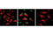 Signal transducer and activator of transcription 1-alpha/beta antibody, 9177S, Cell Signaling Technology, Immunocytochemistry image 