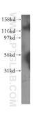 USP21 antibody, 12199-1-AP, Proteintech Group, Western Blot image 