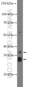 Zinc Finger DHHC-Type Containing 12 antibody, 26433-1-AP, Proteintech Group, Western Blot image 