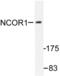 NCOR1 antibody, LS-C176338, Lifespan Biosciences, Western Blot image 