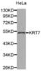 Keratin 7 antibody, abx002011, Abbexa, Western Blot image 