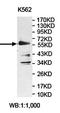 Zinc Finger Protein 77 antibody, orb78300, Biorbyt, Western Blot image 