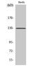 BCAR1 Scaffold Protein, Cas Family Member antibody, STJ94854, St John