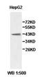 Aldehyde Dehydrogenase 3 Family Member B2 antibody, orb77921, Biorbyt, Western Blot image 