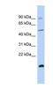 Zinc finger protein 645 antibody, NBP1-80410, Novus Biologicals, Western Blot image 