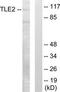 TLE Family Member 2, Transcriptional Corepressor antibody, TA312089, Origene, Western Blot image 