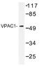 Vasoactive Intestinal Peptide Receptor 1 antibody, AP01436PU-N, Origene, Western Blot image 