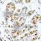 Protein Inhibitor Of Activated STAT 3 antibody, A7060, ABclonal Technology, Immunohistochemistry paraffin image 