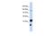 DNA mismatch repair protein Mlh3 antibody, PA5-42166, Invitrogen Antibodies, Western Blot image 
