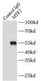 Metal Response Element Binding Transcription Factor 2 antibody, FNab05397, FineTest, Immunoprecipitation image 