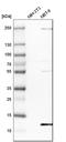 Dynein Light Chain Tctex-Type 3 antibody, HPA003938, Atlas Antibodies, Western Blot image 