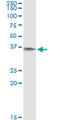BVR A antibody, LS-C139310, Lifespan Biosciences, Immunoprecipitation image 
