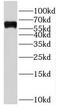 Solute Carrier Family 22 Member 15 antibody, FNab07920, FineTest, Western Blot image 