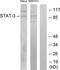 STAT3 antibody, TA326213, Origene, Western Blot image 