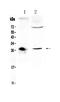 CD151 Molecule (Raph Blood Group) antibody, A02320-1, Boster Biological Technology, Western Blot image 