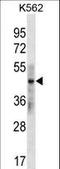 Keratin 33B antibody, LS-C160022, Lifespan Biosciences, Western Blot image 