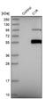 Complement C1r subcomponent antibody, NBP1-86527, Novus Biologicals, Western Blot image 