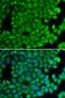 Heat Shock Protein Family B (Small) Member 2 antibody, orb167160, Biorbyt, Immunofluorescence image 