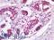 Tumor Protein P63 antibody, LS-A12934, Lifespan Biosciences, Immunohistochemistry paraffin image 